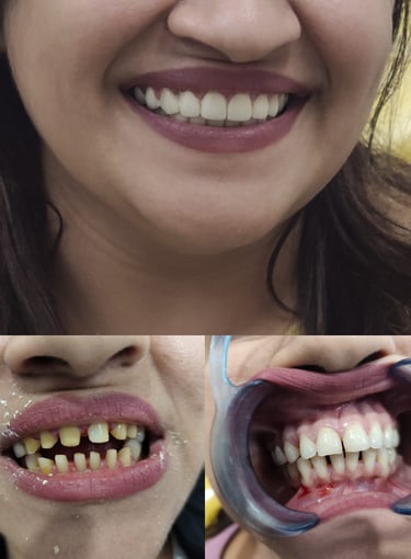 Veena Dental Care Virar
