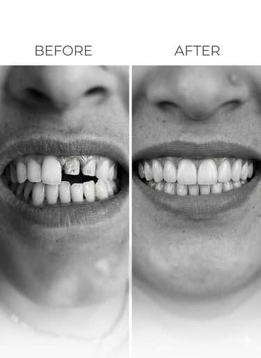 Veena Dental Care Virar