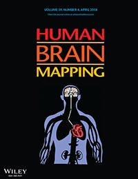 EEG/MEG source imaging using fMRI informed time-variant constraints
