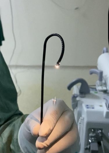 Böbrek taşı lazer taş kırma