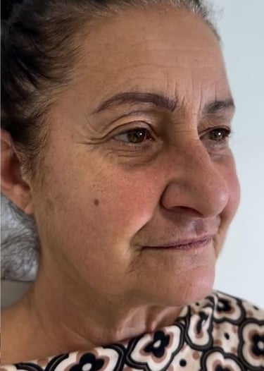 Viso PRIMA del Trattamento Lipolite Viso