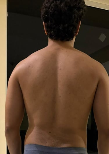 um homem com costas de poucos músculos