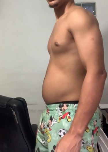 antes e depoiis falso magro