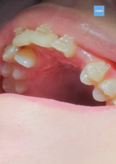 Niños en clínica dental en Badajoz