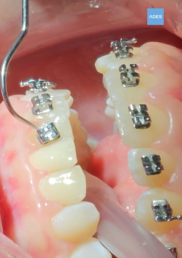 brackets metalicos badajoz