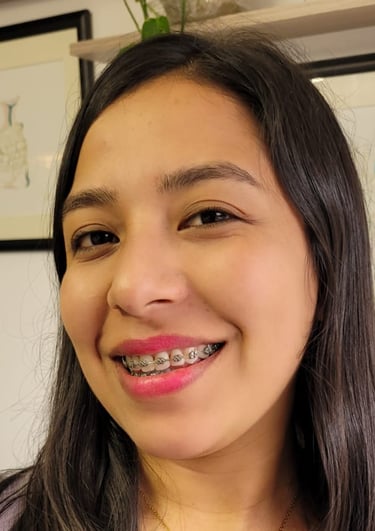 Sonrisa perfecta después de ortodoncia en DUPRINS Lima - Brackets y alineadores dentales