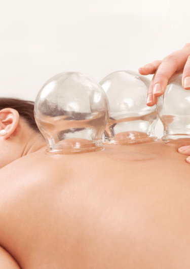 Cupping therapie voor spierherstel en detoxificatie, uitgevoerd door Medisch Pedicure Grote Berg.