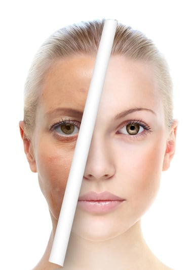eliminar manchas, paño, melasma