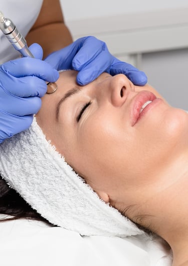 Microdermabrasion skincare clinic beirut