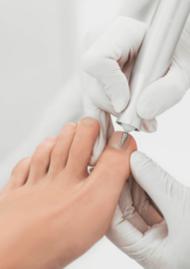 Professionele voetverzorging met een medisch instrument uitgevoerd door een pedicure.