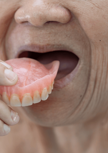 Full and partial dentures offering customized dental care to replace missing teeth and restore oral 