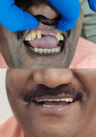 Veena Dental Care Virar