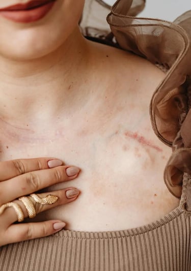 a woman with a scar on her chest