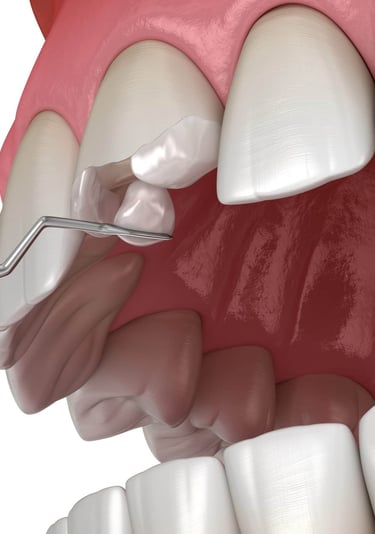 dentist in baner