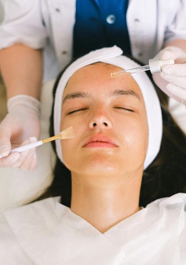 Chemical Peel and Platelet-Rich Plasma