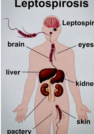 ⚖️ 🥣 🌙 داء اللولبية النحيفة : من أعراض "ألم الساق" إلى مخاطر داء ويل.. هل الصيام مفيد؟ ⏳ 🚫