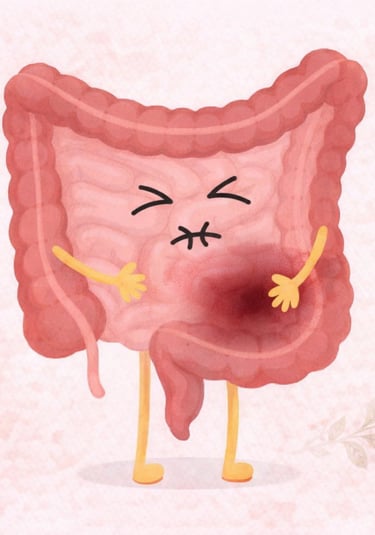 incontinenza intestinale sintomi difficoltà controllo intestino donna