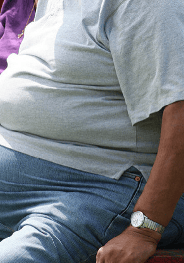 Obesity man