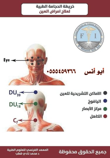 حجامه منزليه
