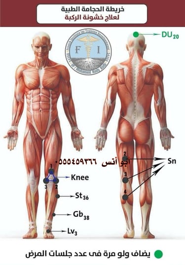 اخصائي حجامه منزليه مكه