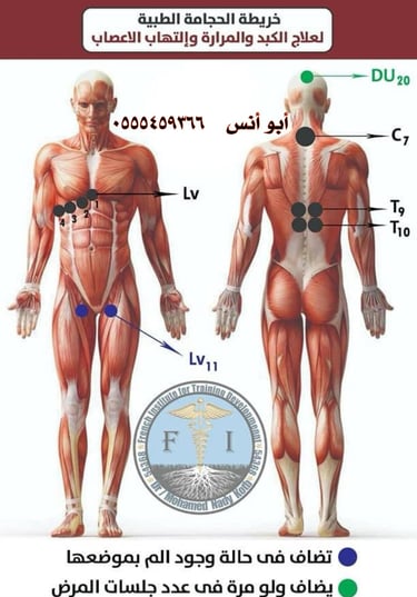 حجامه في مكة
