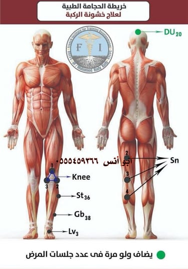 حجامه منزليه مكه