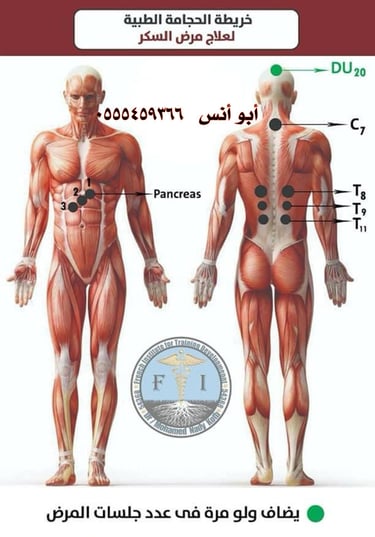 ابو انس للحجامه