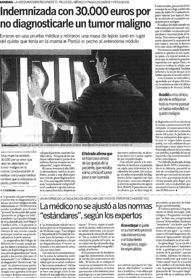 cáncer de mama tumor maligno en el pecho