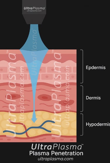 _ultra_plasma_ultra_plazma