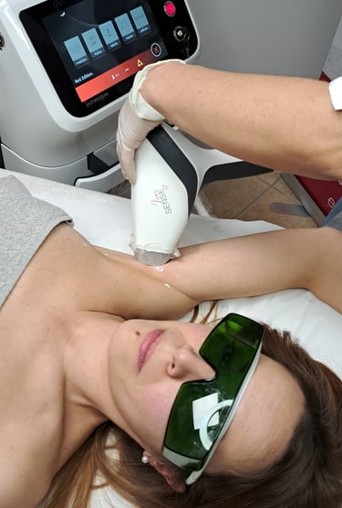 epilazione laser al diodo definitiva per viso e corpo a Riccione