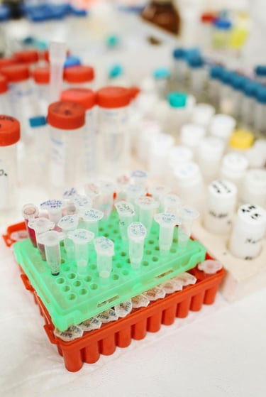 Labeled plastic microcentrifuge tubes in a green laboratory rack for medical research and testing.