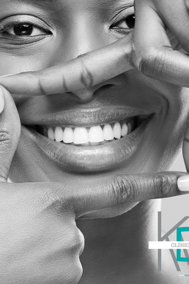 Mujer sonriente mostrando dientes blancos en fotografía en blanco y negro, con logo de KMD Clíni