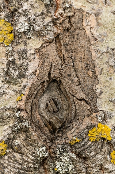 Trattamento Lichen Sclerosus Torino VenaPelvic Center Ostetrica Rebecca Robino