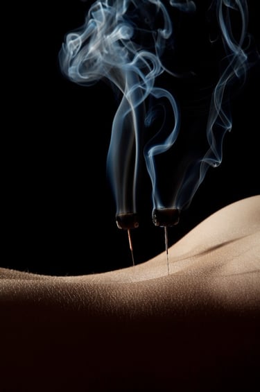 acupuncture north london clinic