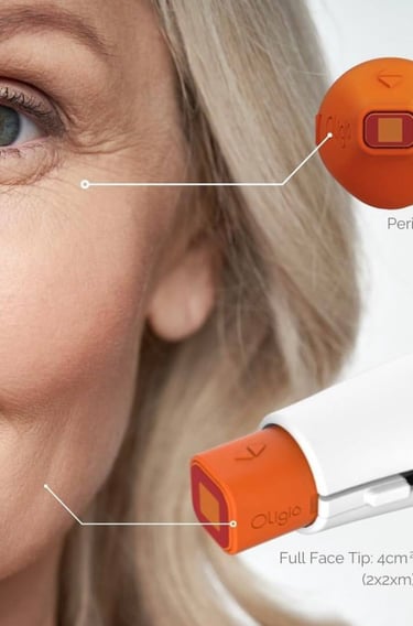 monopolar radiofrequency RF skin tightening