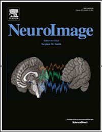 Multimodal neuroimaging with optically pumped magnetometers: A simultaneous MEG-EEG-fNIRS acquisiti