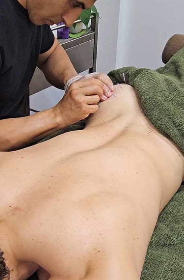 Male therapist performing Dry Needling on Glutes