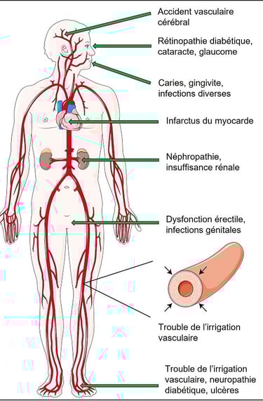 complications du diabète