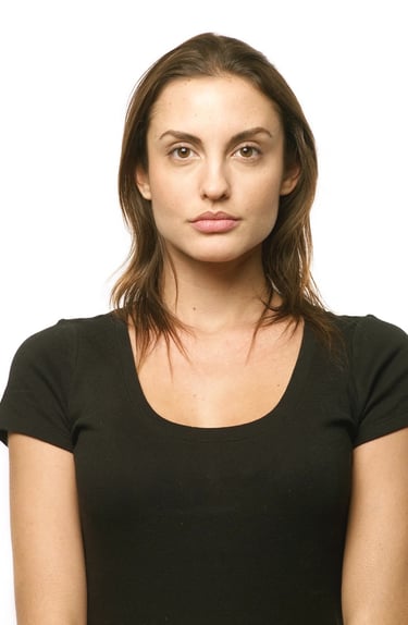 Before Hair Enhancement by Ilona provides hair loss and thinning solution she needs help