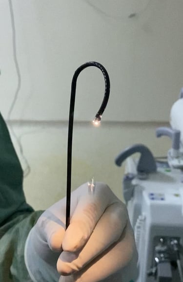 Böbrek taşı lazer taş kırma