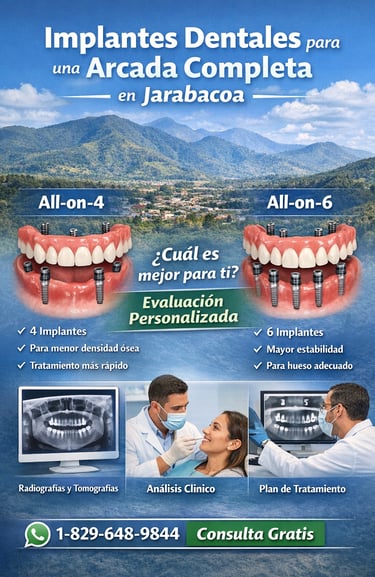Implantes dentales para una arcada completa en Jarabacoa
