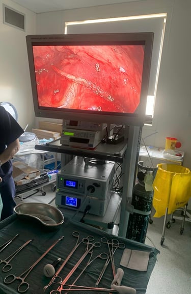 Lung surgery Malta keyhole minimally invasive