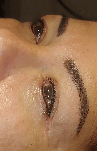 Smudge-proof upper and lower eyeliner tattoo