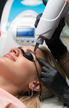 Remoção de tatuagem a laser