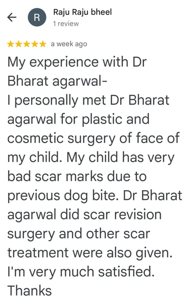 "Burn Cosmetic Aesthetic & Reconstructive Best Plastic surgeon in Udaipur"