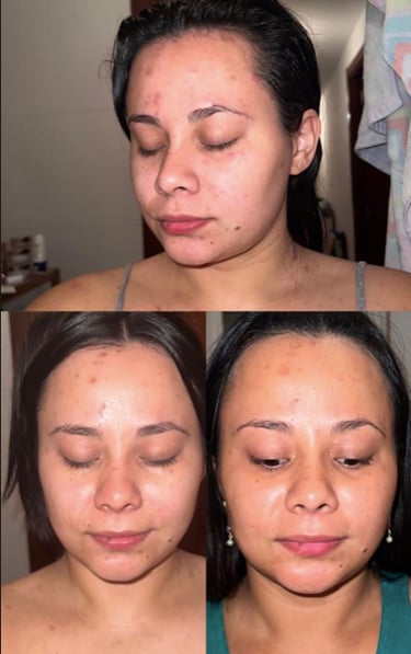 before and after of a woman with a lot of wrinkles on her face