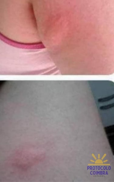 Photos with side effects of the conventional medication.