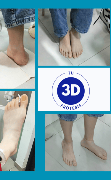Protesis para pie, protesis en silicona para personas que no tienen alguna parte de su cuerpo