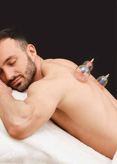 cupping massage in wollongong - part of sports massage
