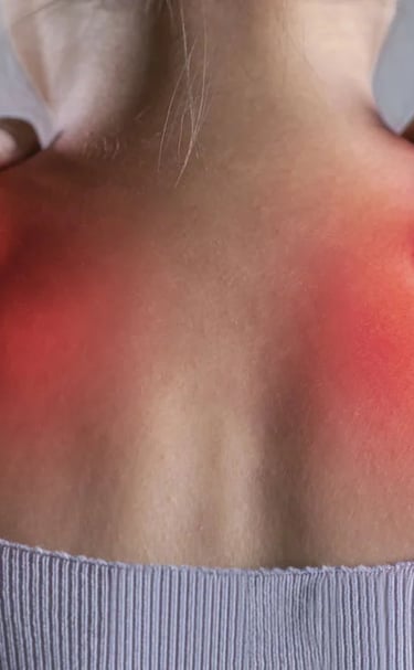 Mulher com as mãos em ambos os ombros avermelhados